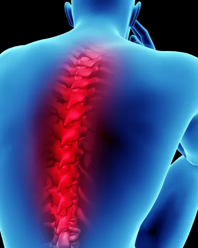Medical illustration of a blue male torso with the spine highlighted in glowing red, signifying back pain or injury.