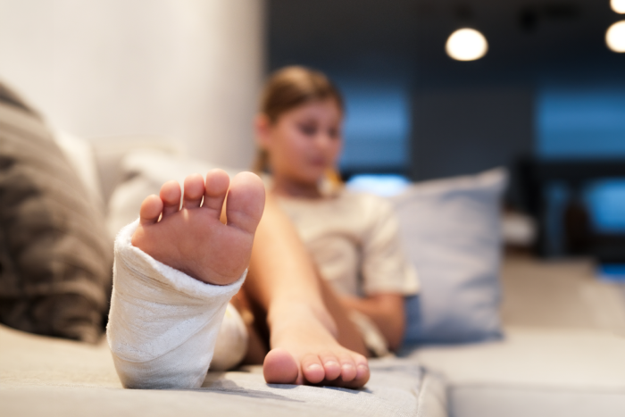 A teenage girl with a cast on her leg sits in the living room on the sofa. A teenager has a broken leg with crutches in the background.